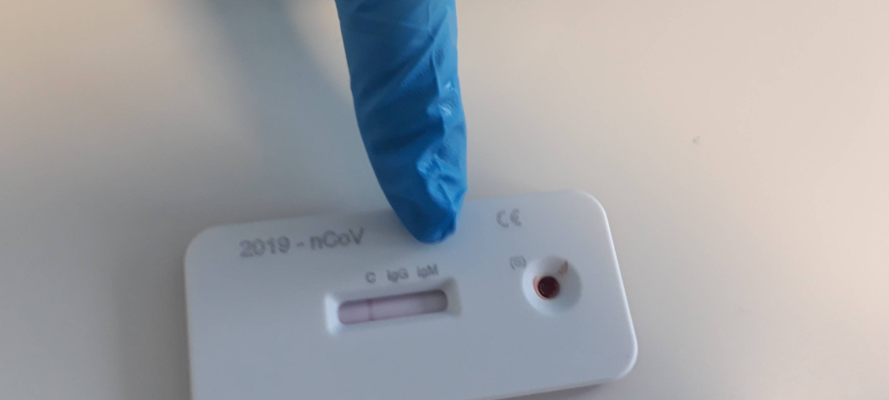 Kampf gegen das Coronavirus - Neuer Test aus Wesel