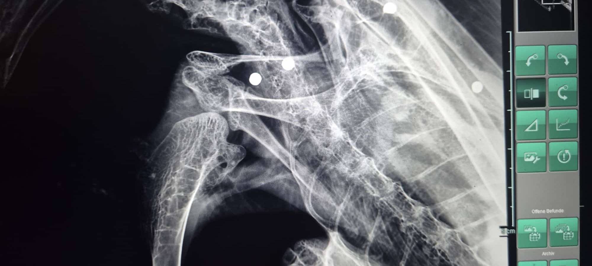 In Kamp-Lintfort wurde auf Mäusebussard geschossen